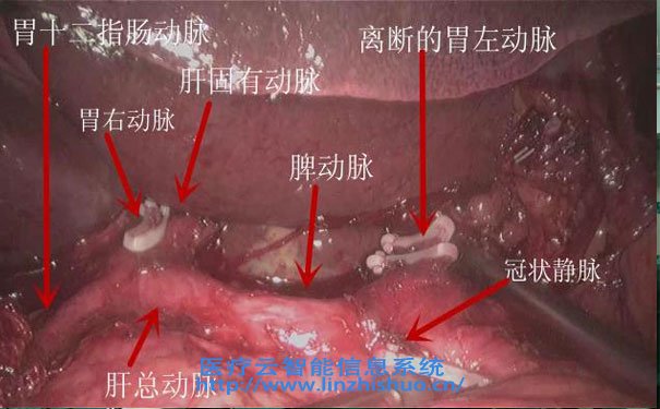 高清手术示教系统