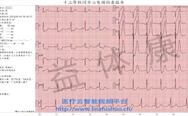 远程心电会诊系统