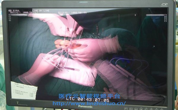 视频手术示教系统