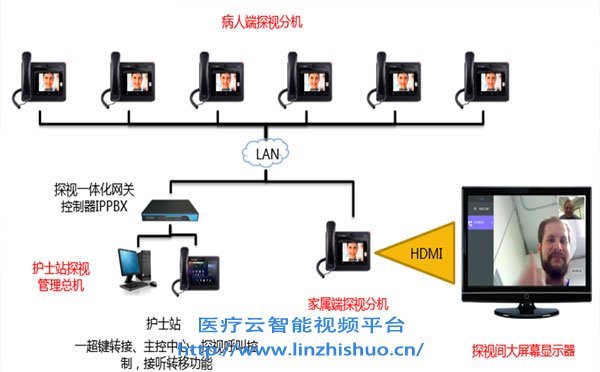 无线icu探视系统